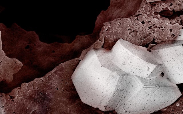 Electron Microscope Food Photos by Caren Alpert Electron Microscope Food Photos by Caren Alpert