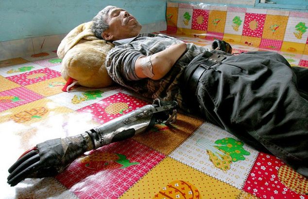 Chinese man builds his own prosthetic arms