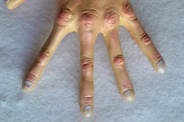 Hand