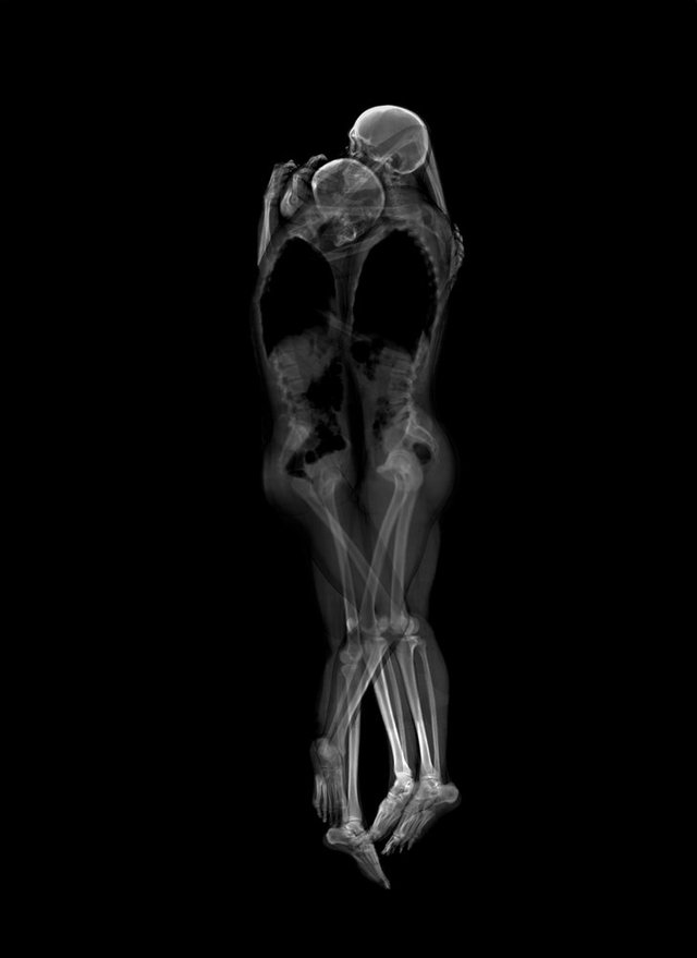 X-Ray Portraits