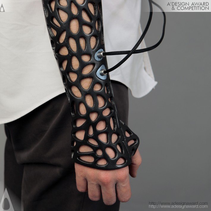 Osteoid Cast