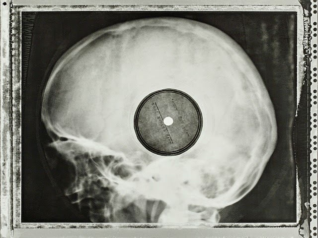 X-ray LP
