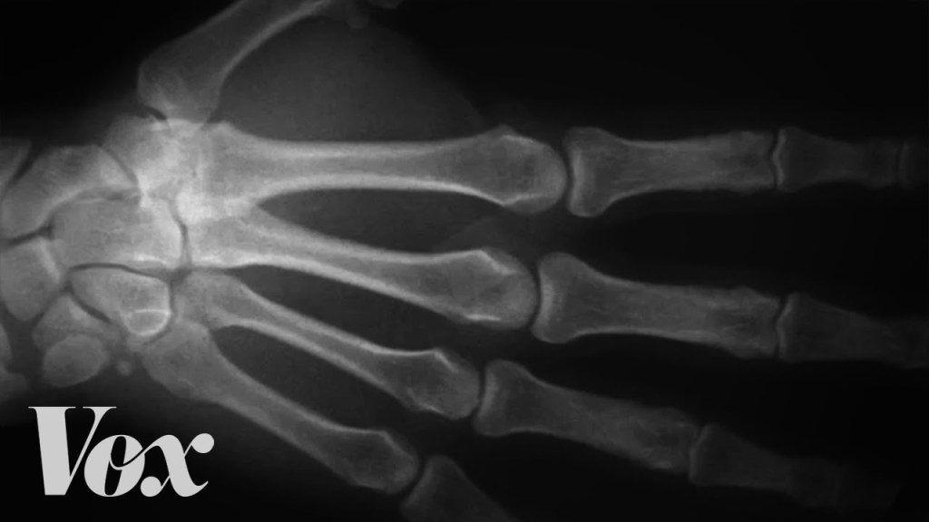 Researcher Cracks His Knuckles in Only One Hand for Over 60 Years to