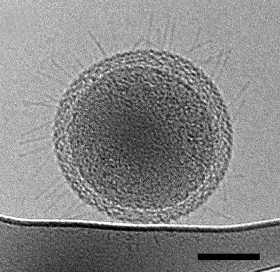 ultra-small bacteria 2