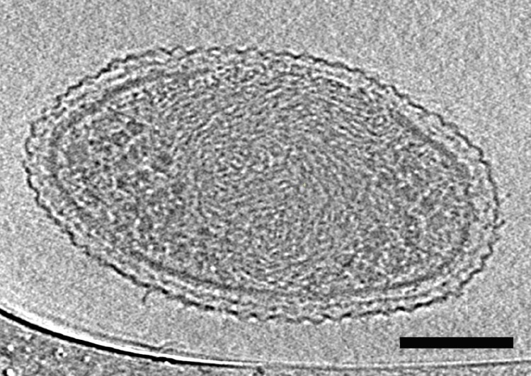 ultra-small bacteria