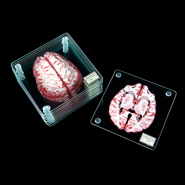 Brain Sections