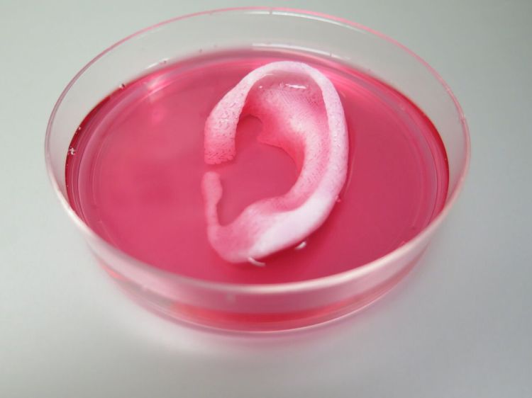 3D Bioprinted Ear