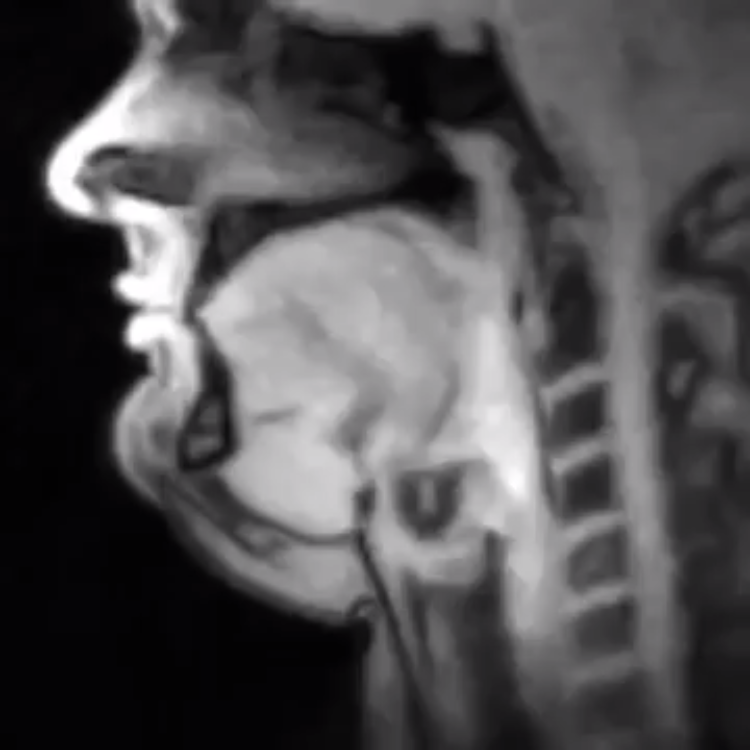 real-time-mri.png