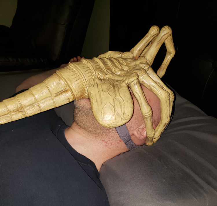 Man Turns His Cpap Mask Into An Alien Facehugger