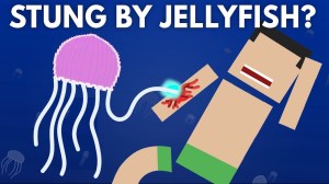 Stung by Jellyfish
