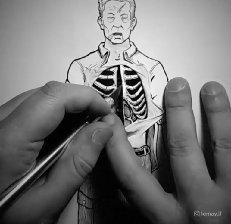 Life Saving Surgery on Illustration