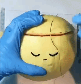 Fruit Surgery