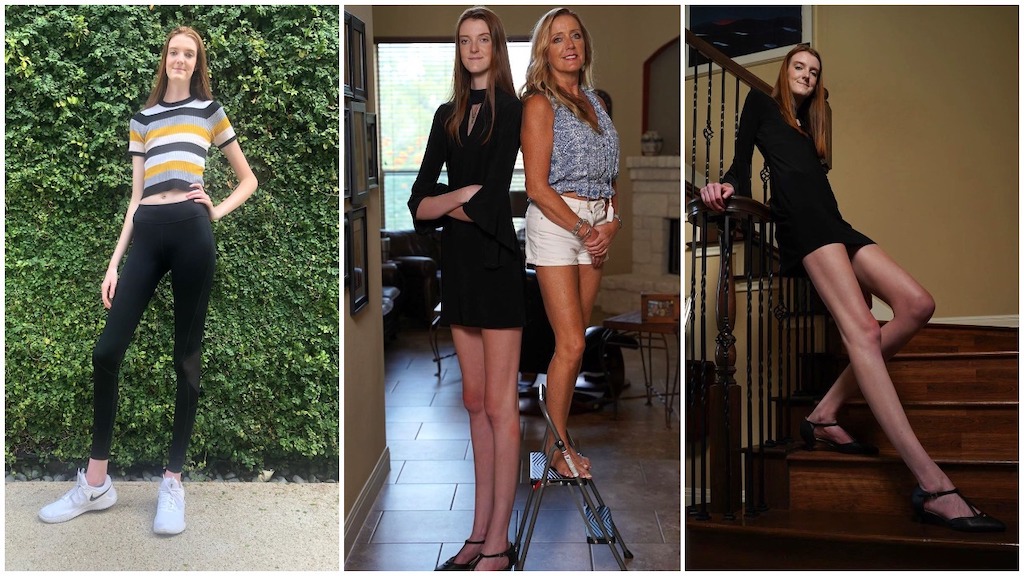 Texas Teenager Breaks the Guinness World Record for the Female With the  Longest Legs