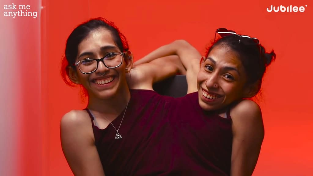 An 'Ask Us Anything' Interview with Conjoined Twins Carmen and Lupita  Andrade