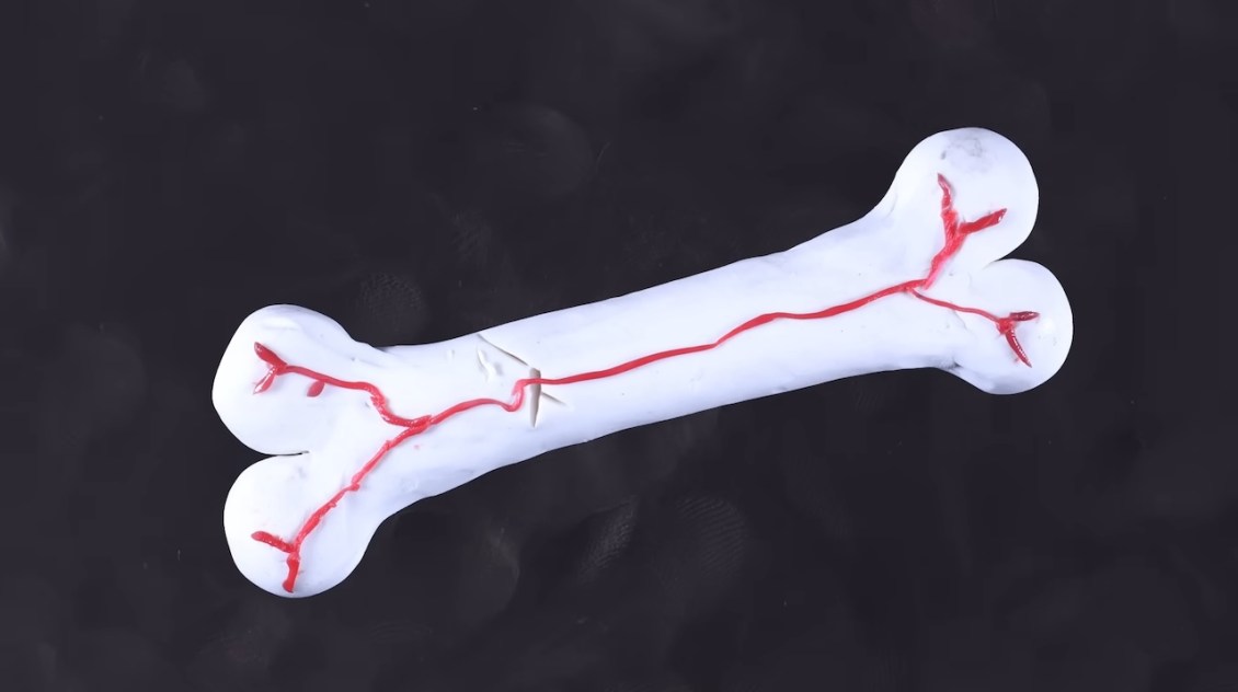 The Fascinating Process of How Broken Bones Heal
