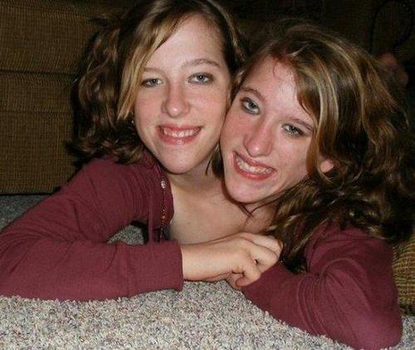 Abby And Brittany A Reality Show That Follows The Conjoined Hensel