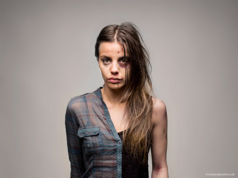 Half before and after portraits of drug abuse by Roman Sakovich