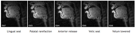 X-ray style view of human beatboxing