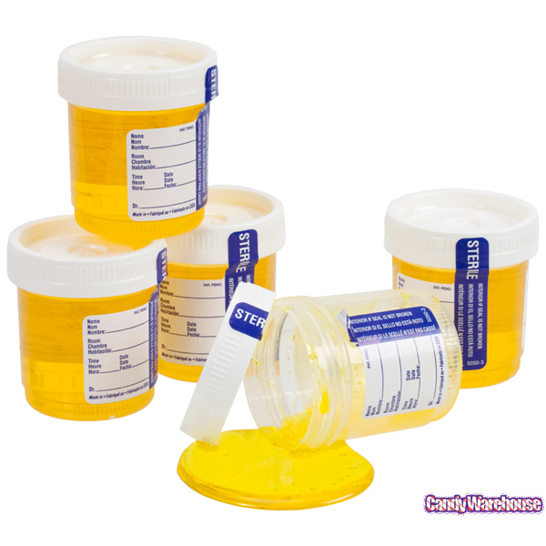 Sour Yellow Liquidy Candy Packaged in Urine Sample Bottles
